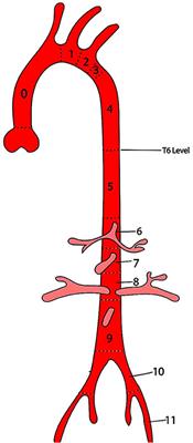 Comprehensive review of hybrid aortic arch repair with focus on zone 0 TEVAR and our institutional experience